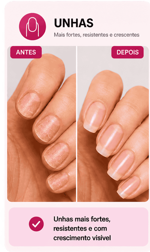 Antes e depois — unhas